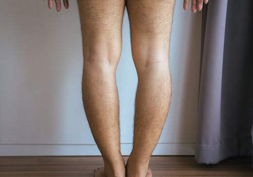 美脚の敵であるXO脚の原因と予防方法を紹介